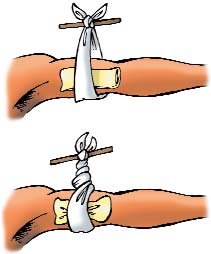  PRIMEROS AUXILIOS (83)  IMAGENES DIBUJOS JPG GALICIA